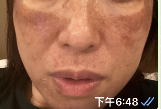 管理層約以抄咗相關同事及完全不知情作藉口。完全沒有對本人此次受傷負責任,只退療程餘款。
就算本人出示,所有醫生證明是他們造成的意外,也表示已經辭退同事👍和公司無關!黑店當之無愧