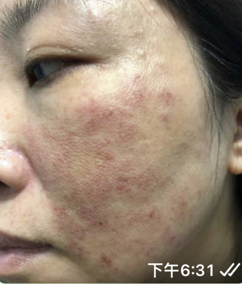 管理層約以抄咗相關同事及完全不知情作藉口。完全沒有對本人此次受傷負責任,只退療程餘款。
就算本人出示,所有醫生證明是他們造成的意外,也表示已經辭退同事👍和公司無關!黑店當之無愧