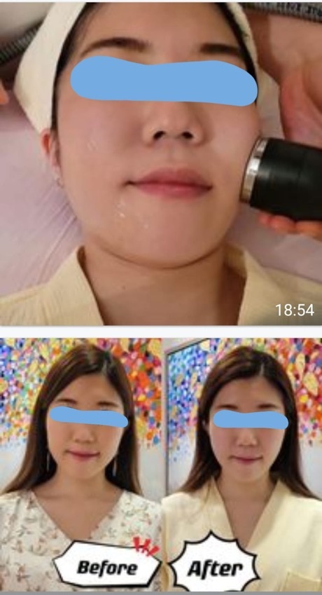 我係may初次到BioSlim體驗獨家徒手塑形面部療程,效果理想,而感覺到好好,洗咗面,就拍相,分析我的面型輪廓,有包包面,水踵少少,輪廓欠尖面,也很明確對我說,一次見到有效果但需要解決所有問題需要的好記次的療程,好專業咁告訴我,不硬销,不多廢話,我有信心,我會繼續再做療程我好想!好想踢走包包面,變番尖瘦輪廓。