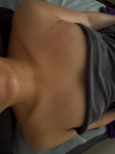 超明顯😍😍，幾日啦，仲係脹卜卜，佢哋真係好細心，仲教我家居護理🥰🥰，真心值得推薦👍🏻👍🏻👍🏻￼