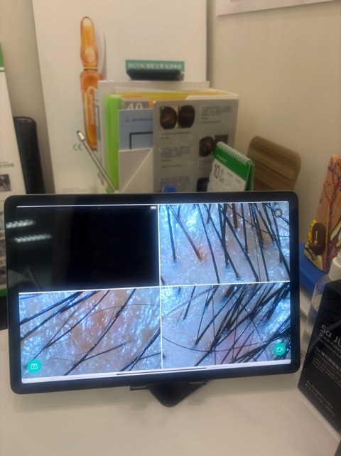 Mia 護照師服務細心,有禮貌,會同我解釋頭皮問題同話我知日常要點樣護理,非常好