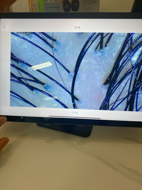 頭皮前后對比好大差別,第一次來服務態度很好,大家可以來體驗一下。