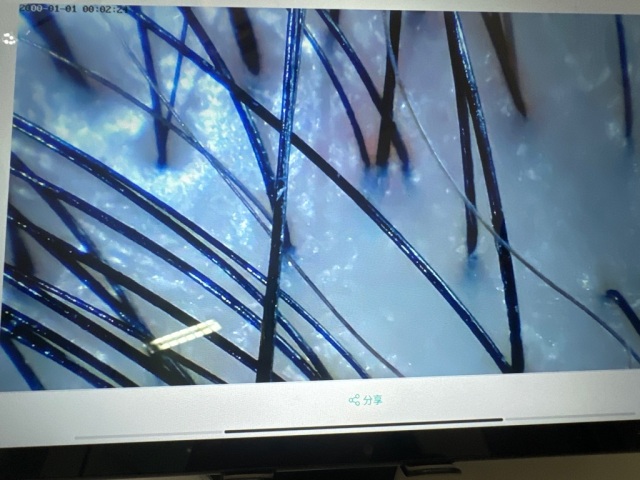 過程舒服,毛髪變好,幫助生髪,下次會再光顧