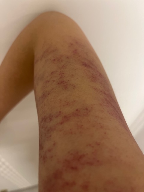 Linda刮沙手勢好好力度合適,刮完啲沙出咗嚟成身鬆咗