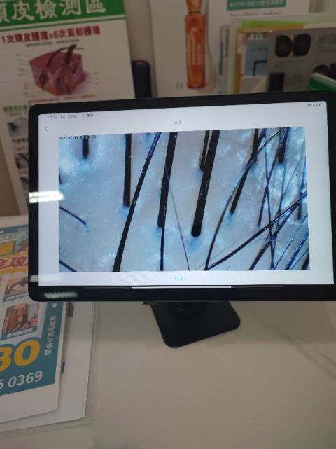 療程非常好,前後做用明顯見到頭皮冇咁油