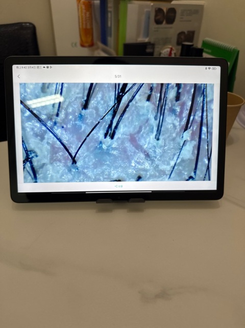 服務態度非常好，療程後明顯見到前後分別，又便宜￼