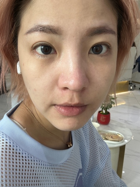 很棒的體驗，環境乾淨、
服務人員非常親切也不會硬銷。
施作手法專業也很仔細，有機會會再來做。
