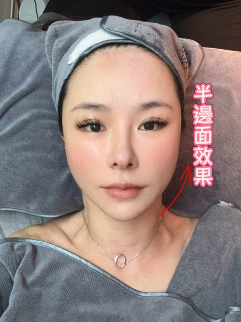 加錢試做鈦超聲
效果非常好,加咗二千幾蚊好靚好靚🫰
繼續幫襯價錢合理乾淨!
產品又好老闆又好夥計又好
