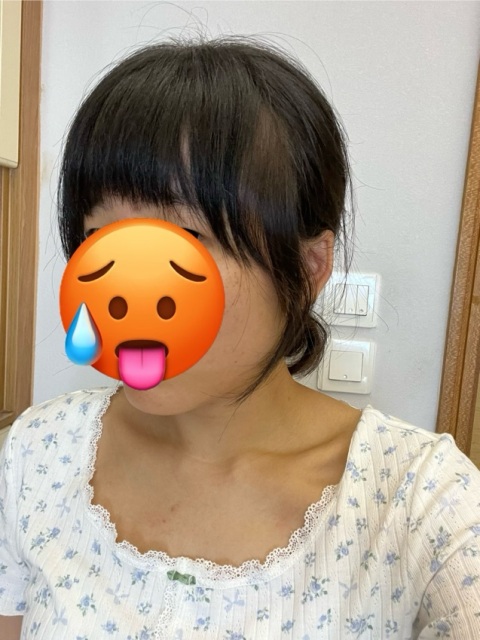 近排比較忙見有時間就喺附近搵間salon剪,見你哋評價唔錯就幾有信心,但呢個故事教訓我哋唔可以隨便轉髮型師。宜家個頭薯到唔想出街,望住個頭好抑鬱,接受唔到一個專業髮型師剪到咁,pat陰厚到好似八兩金咁之餘仲要左右唔對稱。
下個禮拜仲要去旅行…
