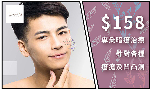 $158 專業暗瘡治療 體驗全面零瑕疵【Ovela MediCenter】-banner