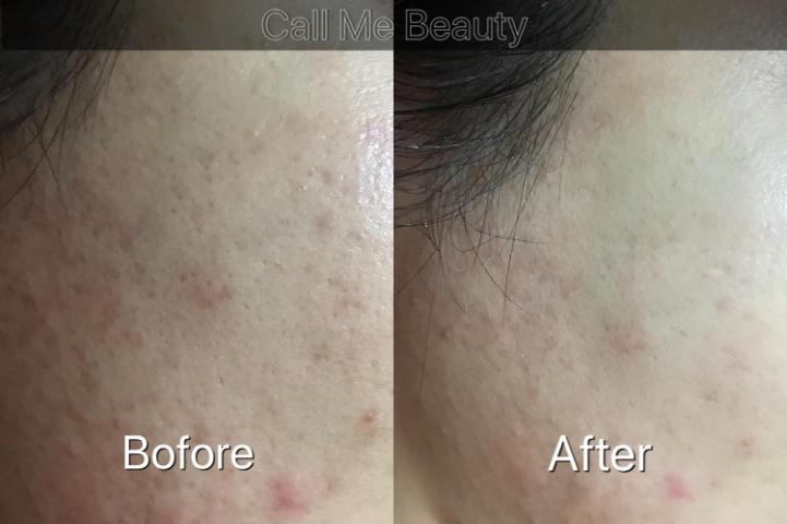 【 海藻半永久嫩膚面部護理 】