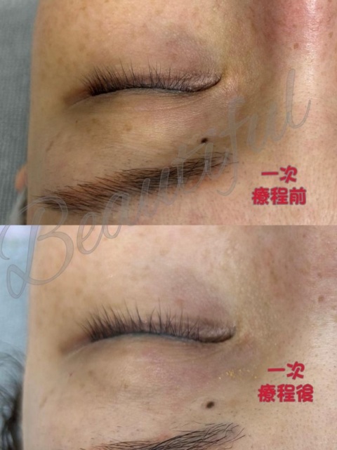 熊貓眼部療程$ 2 9 8