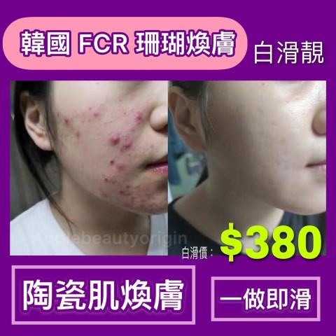 滑嘟嘟陶瓷肌 面部極速去印煥膚