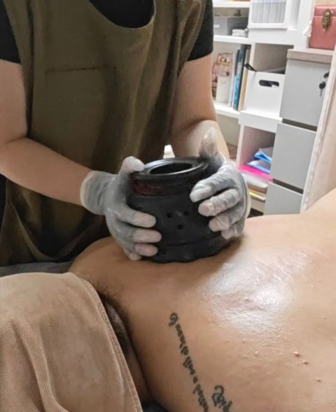 李時珍砭石艾罐養生療程